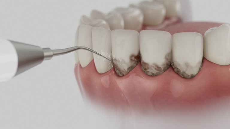 Reliable Emergency Dentist contractor in Lacey, WA by Smile Center Dentistry